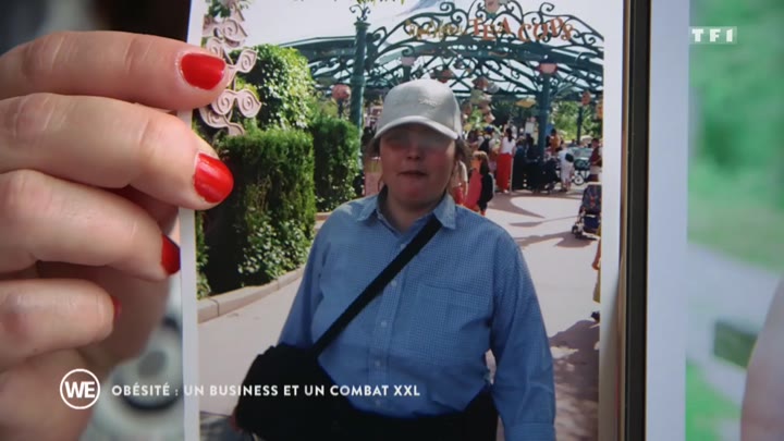 Pour la Ligue contre l'obésité (LCO), le reportage "Obésité : un business et un combat XXL" diffusé samedi 12 octobre sur TF1 ridiculise les personnes souffrant de la maladie obésité.
